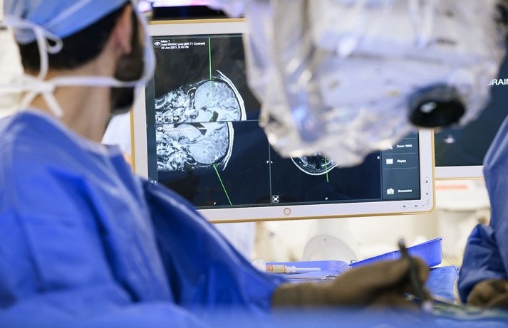 Metástasis Cerebrales: Lo que debes saber